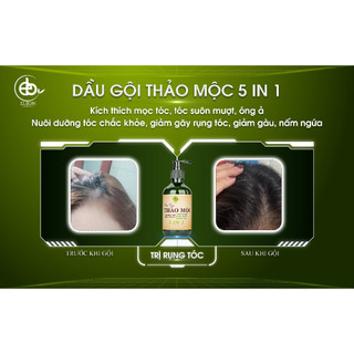 DẦU GỘI THẢO MỘC 5 IN 1 ELBON