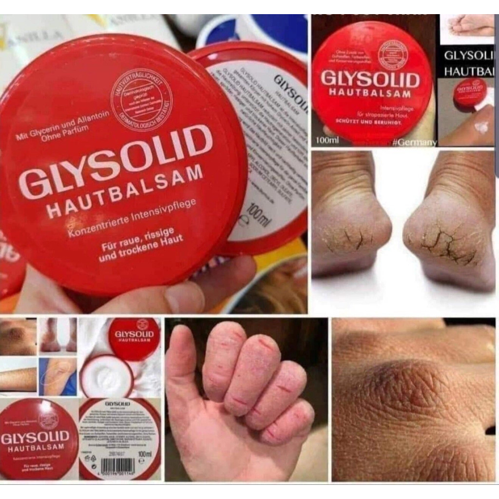 Kem Nẻ Glysolid Hautbalsam của Đức 100ml và dạng tuýp 75ml | BigBuy360 - bigbuy360.vn