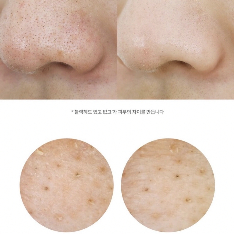 Bộ sản phẩm dưỡng da MANYO