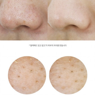 Bộ sản phẩm dưỡng da MANYO Minisize