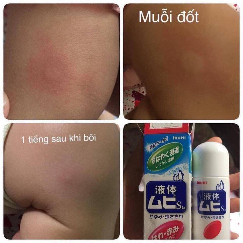 Lăn Bôi Muỗi Đốt Và Côn Trùng Cắn Muhi Chim Cánh Cụt 50ml - Kem muỗi Muhi