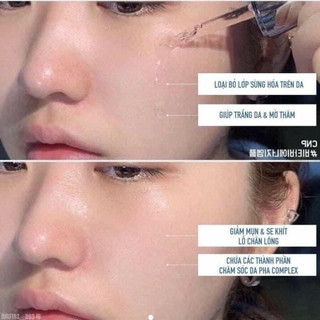 Set dưỡng keo ong Hàn Quốc CNP