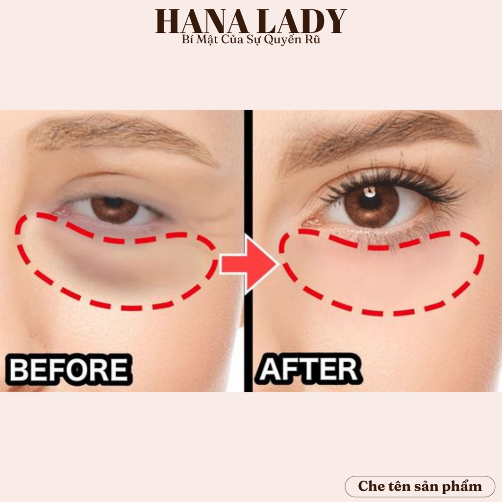 Máy massage mắt mini dạng bút - Máy massage hỗ trợ giảm thâm, chống lão hóa, giảm căng thẳng STO2