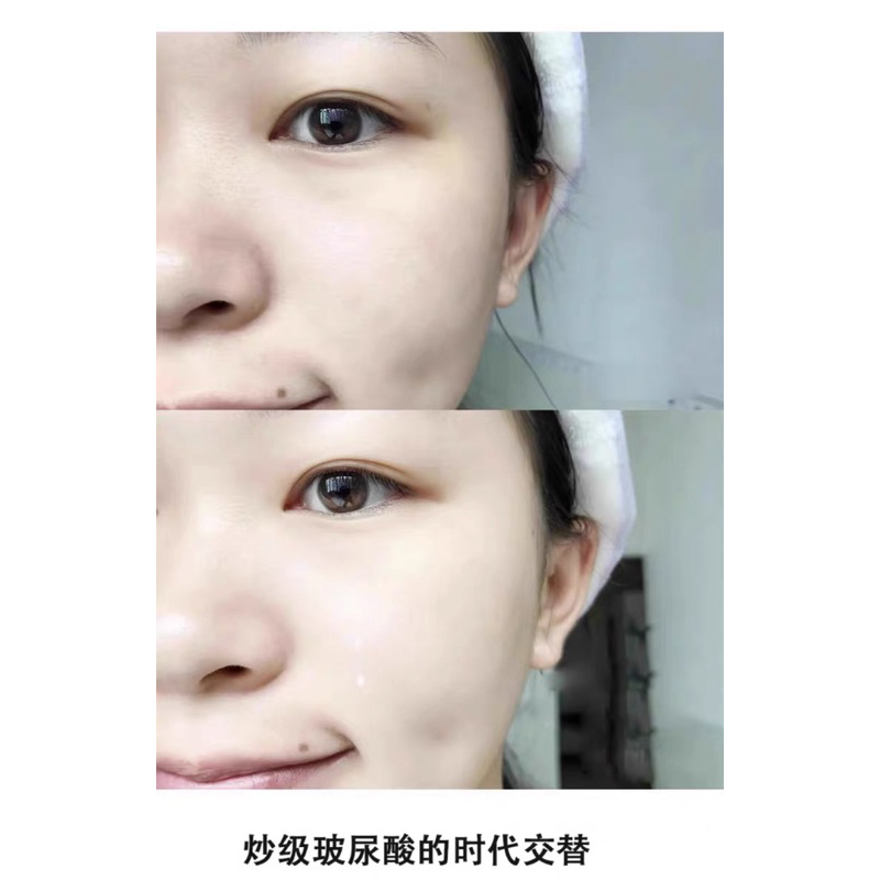 Sữa dưỡng da cấp ẩm VT Super Hyalon 250ml