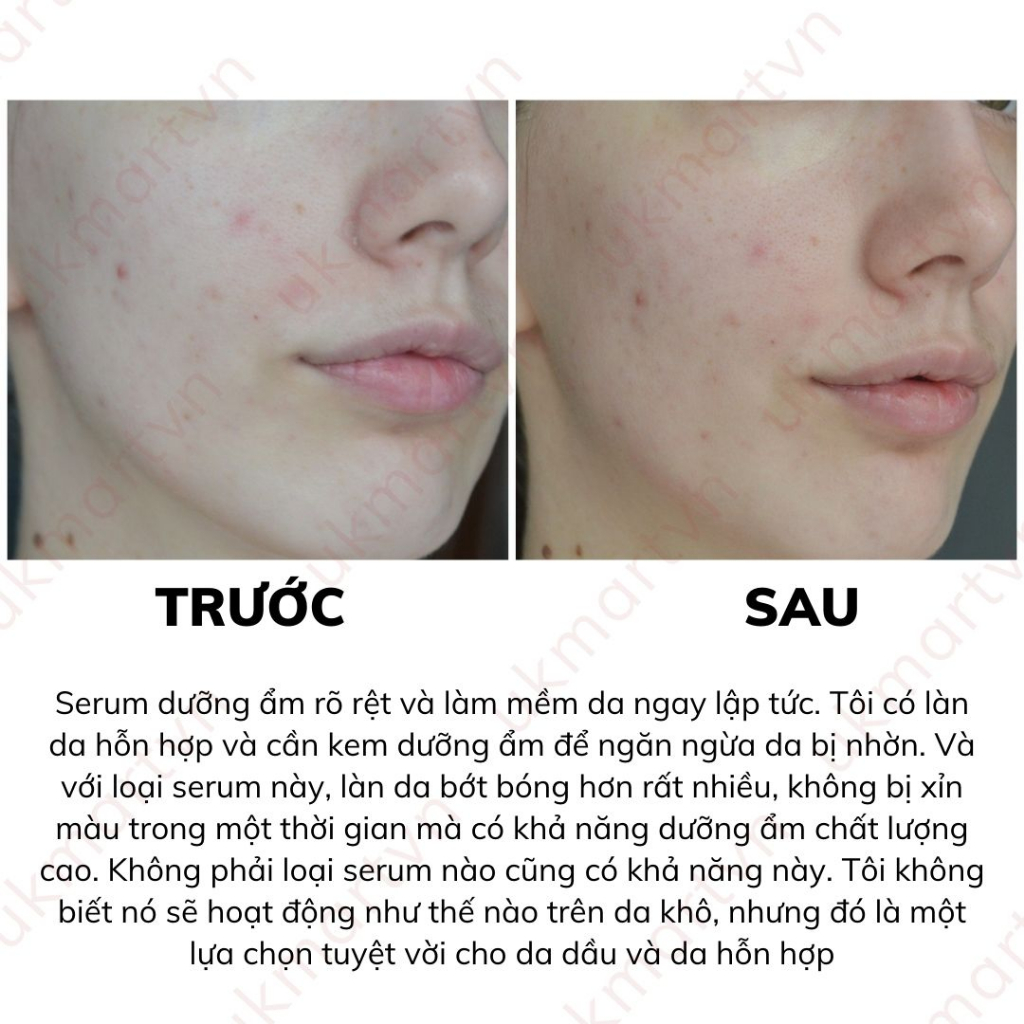 Serum Cấp Nước Compliment Hyaluronic Acid 5%