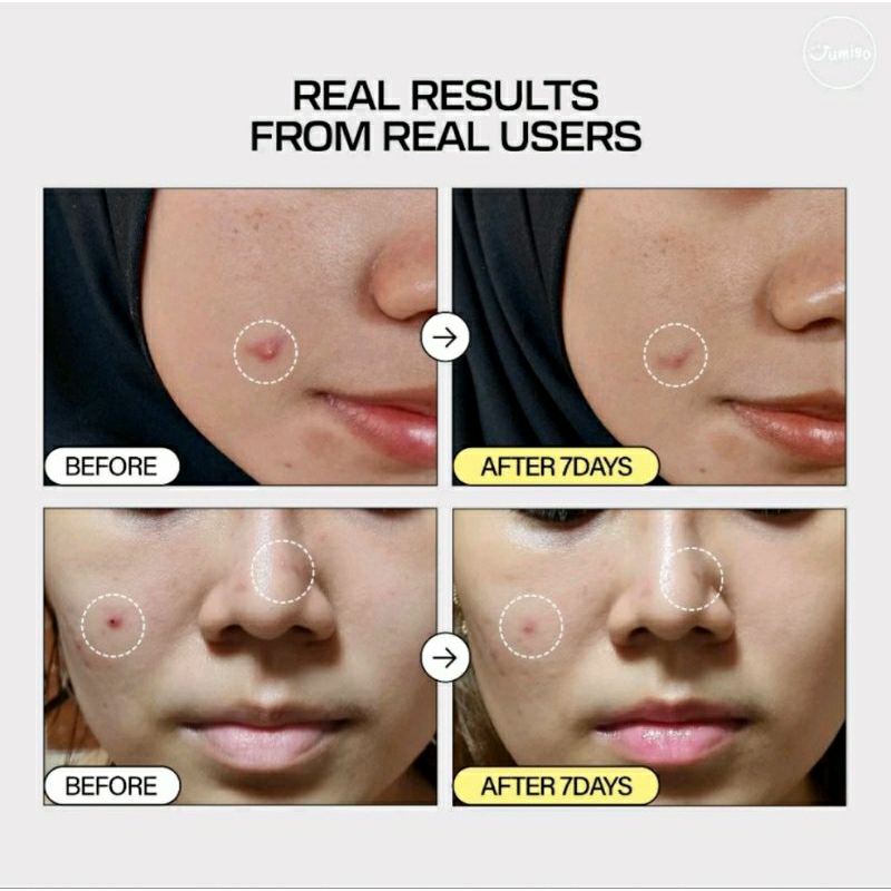 Tinh chất Ốc sên Peptide phục hồi da JUMISO SNAIL MUCIN 95 PEPTIDE FACIAL ESSENCE fullsize 140ml