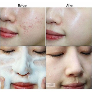 sữa rửa mặt nghệ neutrogena 150ml