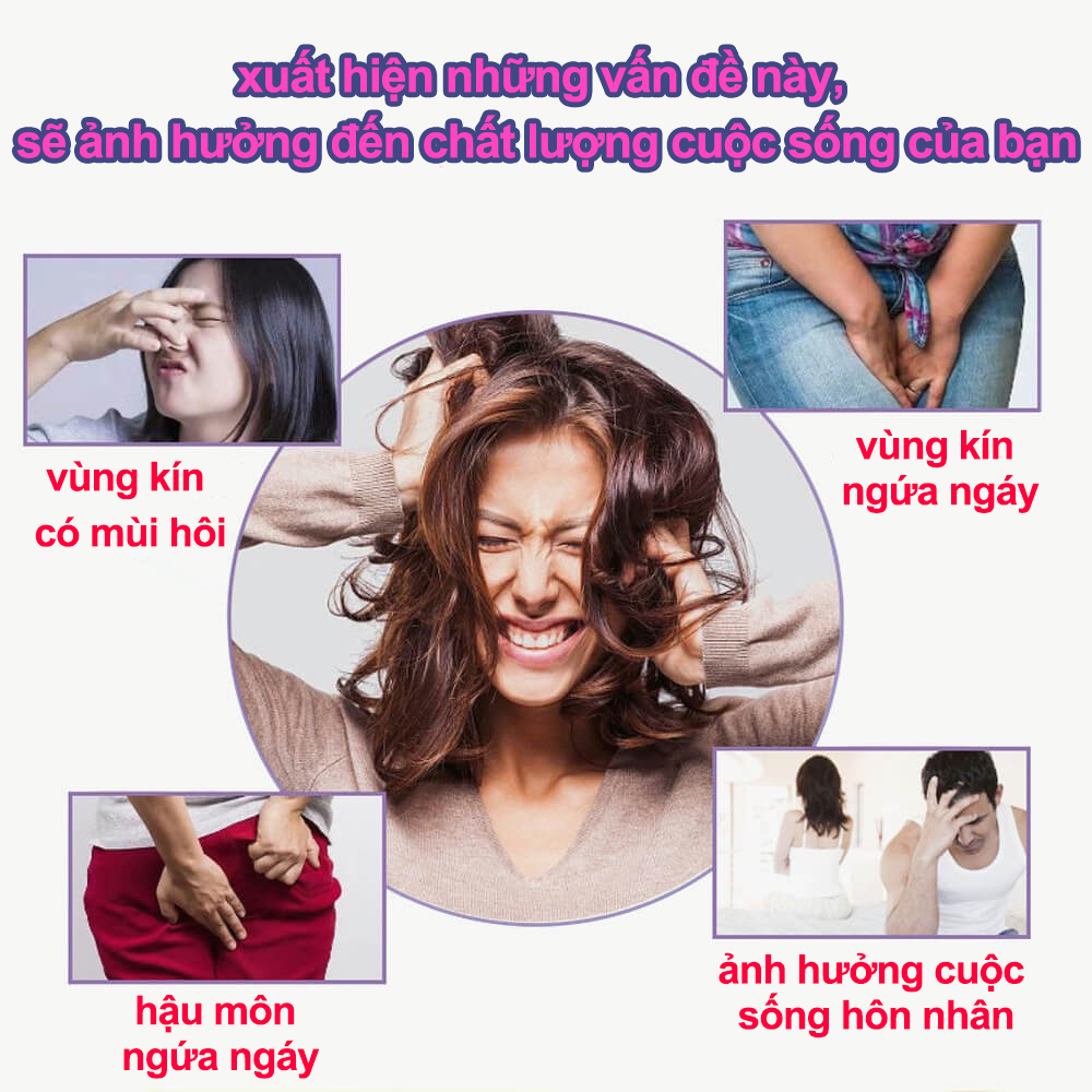 Chăm sóc vùng kín kem Kem giảm ngứa Dùng bên ngoài loại bỏ vùng kín Nấm Ngứa hôi hám kháng khuẩn Làm sạch sâu 30g