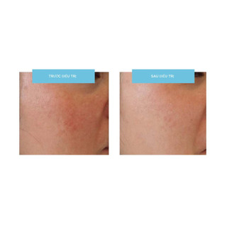 Tinh Chất Trắng Sáng Da MD:Cocktail Tranex White - MD:Ceuticals