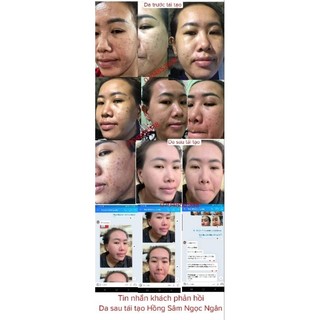 TINH CHẤT HỒNG SÂM TÁI TẠO DA