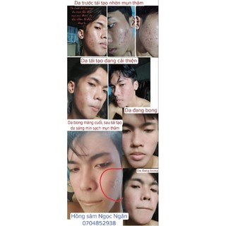 TINH CHẤT HỒNG SÂM TÁI TẠO DA