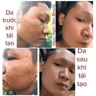 TINH CHẤT HỒNG SÂM TÁI TẠO DA