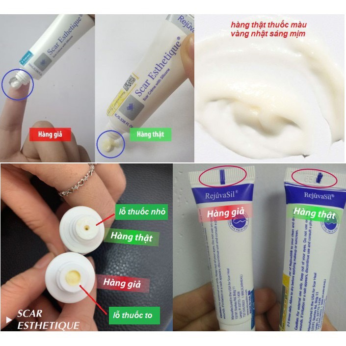 Kem Làm Mờ Sẹo: Sẹo Rỗ, Sẹo Thâm, Sẹo Lõm, Sẹo Thuỷ Đậu, Tai Nạn - Scar Esthetique 10ml-KTSM