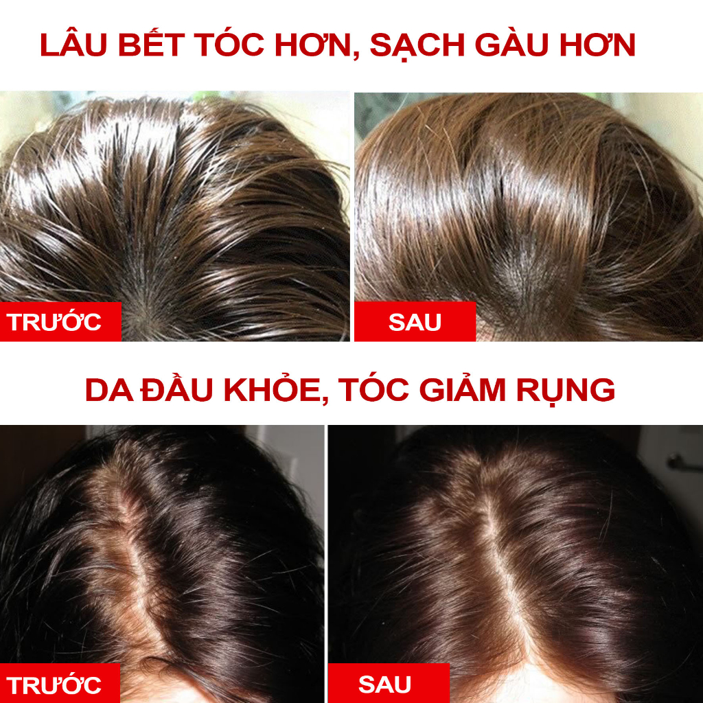 Tẩy tế bào chết da đầu Coigarden 300gr sạch gàu lâu bết - Tẩy tế bào chết da đầu sạch gàu