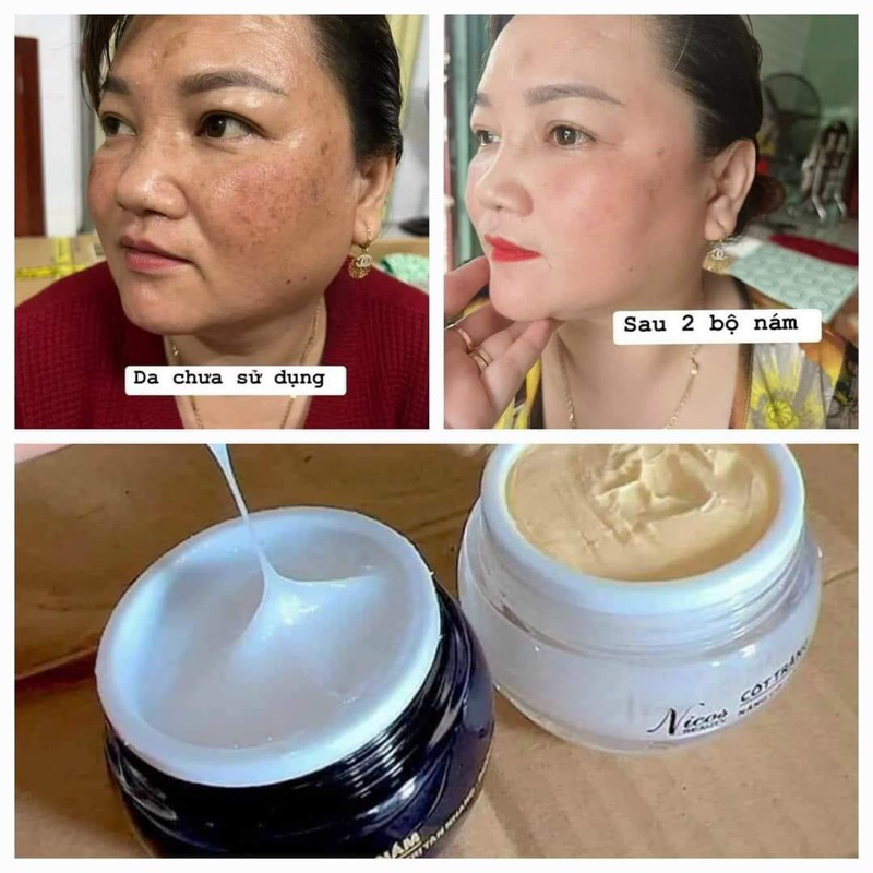 Combo Kem Face Cốt Nám Đông Y Nikos Chính Hãng- Kem Face Nikos Cốt Trắng Căng Bóng Nâng Cơ