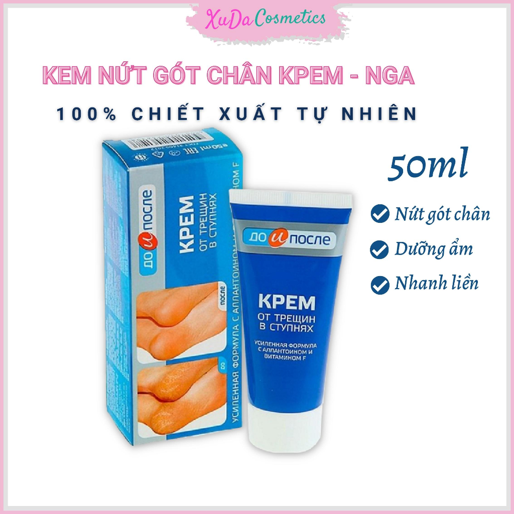 Kem nứt gót chân Kpem Nga dưỡng gót nẻ mềm mại phục hồi tái tạo nhanh liền vết nứt nẻ 50ml