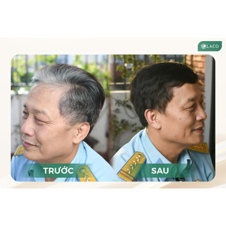 Dầu gội phủ bạc Laco