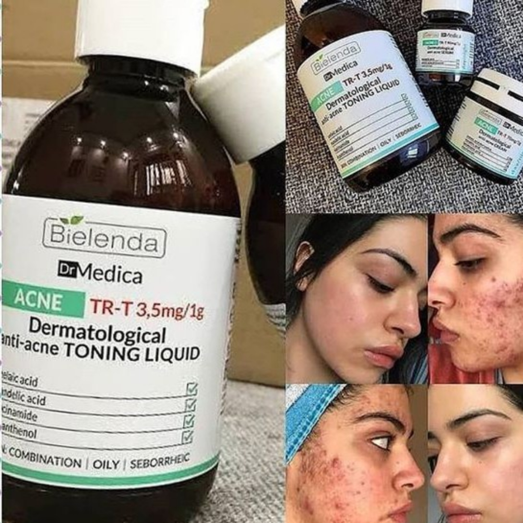 Sữa rửa mặt Bielenda Dr.Medica Anti-acne Dermatological Cleansing Emulsion - Giảm mụn, làm sạch sâu mà vẫn êm dịu 250mL