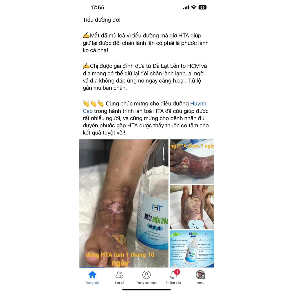 Nước Muối Điện Hóa  Anolyte HTA Dung Tích 1500ml Sát Khuẩn Diệt irut 99,99%