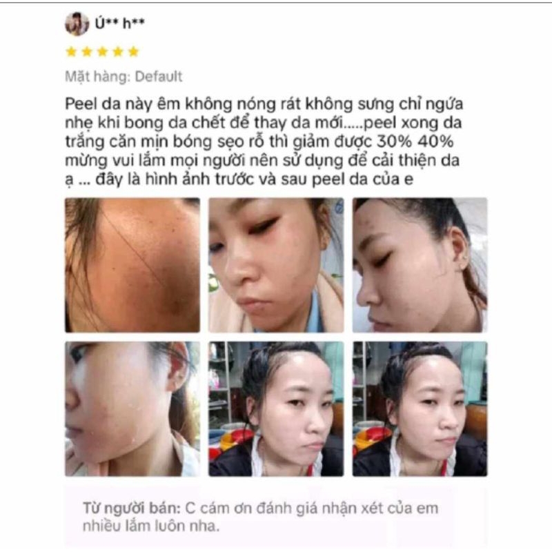 KEM FACE PELL DA SINH HỌC RETINOL TÁI TẠO DA SAU 7 NGÀY SỬ DỤNG