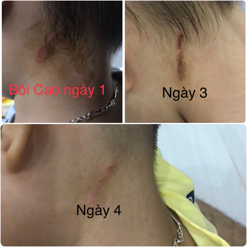 Cao lá Muồng Trâu 50ml