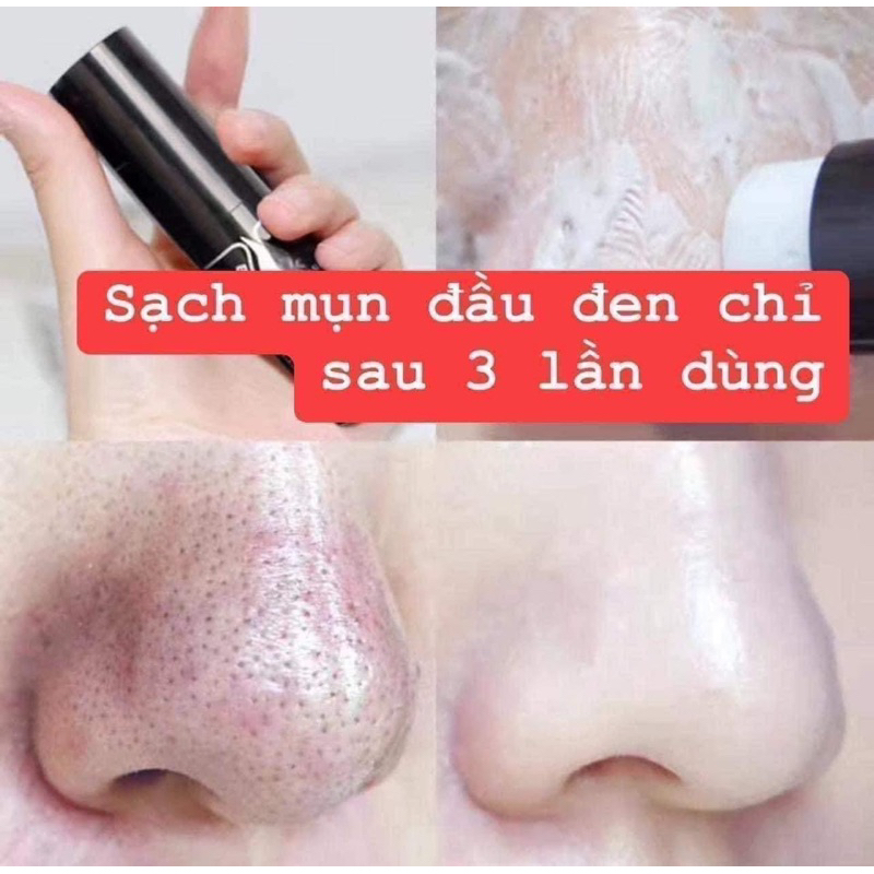 Thanh lăn giảm mụn đầu đen Rire All Kill Blackhead Remover Stick