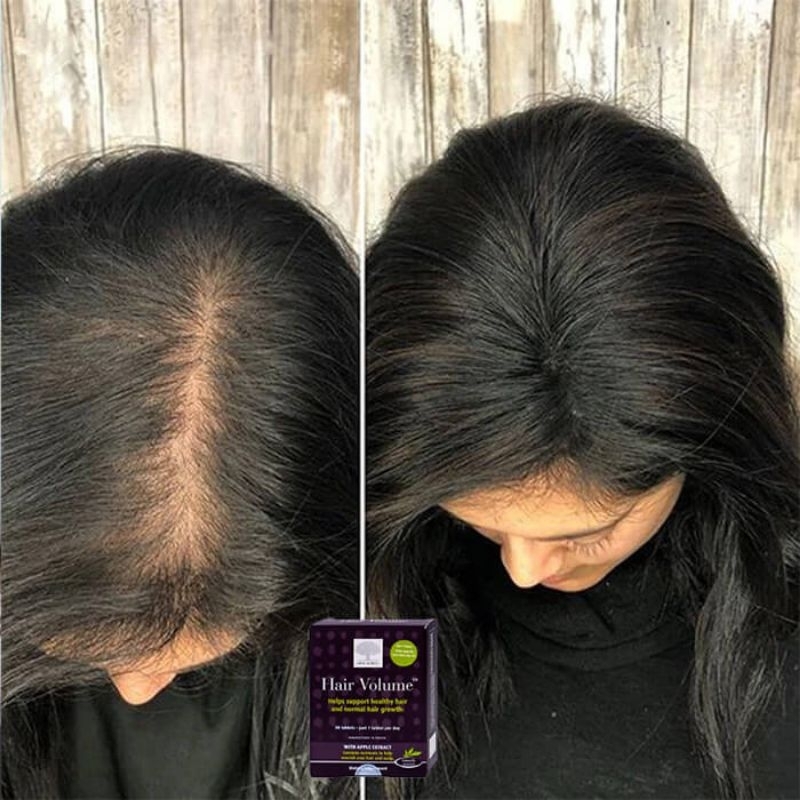 Viên uống kích mọc tóc, dài tóc, dưỡng tóc Hair Volume New Nordic