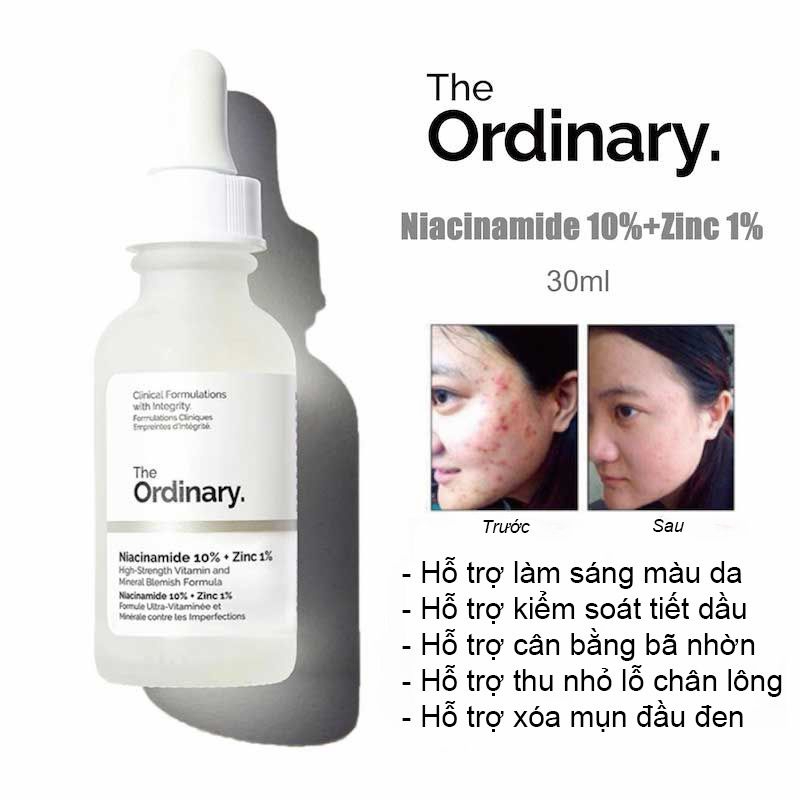 Tinh chất Niacinamide 10% + Zinc 1% 30ml The Ordinary Làm sáng da, thu nhỏ lỗ chân lông bản Canada