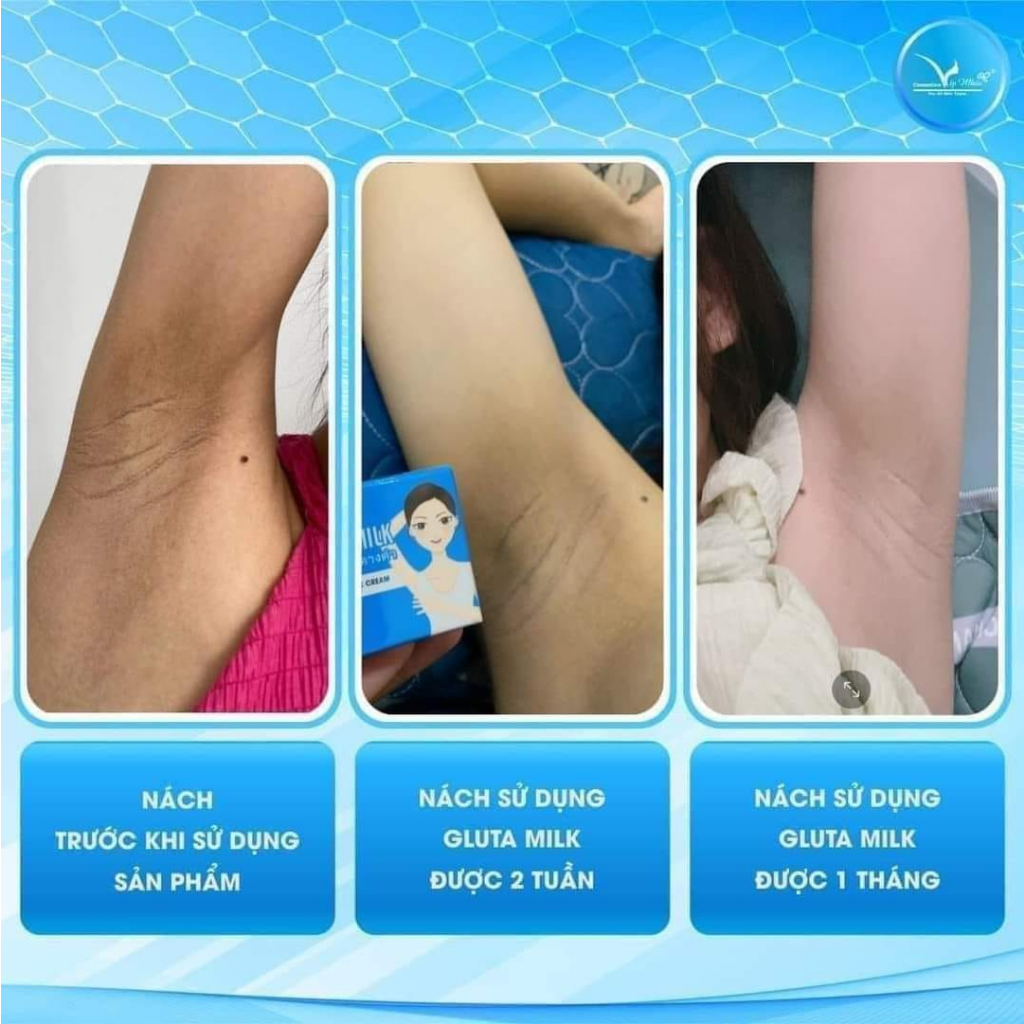 Kem Giảm Thâm Nách,Thâm Mông, Đầu Gối, Khuỷu Tay Gluta Milk Thái Lan15g Tặng Tuýp Nhỏ 10gr Giúp Da Trắng Mịn Khử Mùi