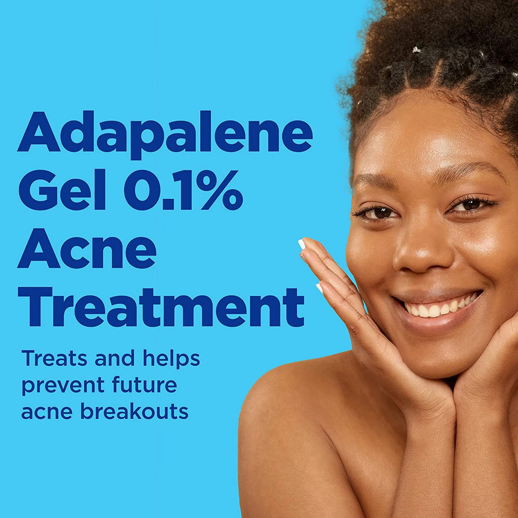 [BẢN MỚI] Gel dưỡng chấm mụn Differin Adapalene Gel 0.1% Acne Treatment bản Mỹ 15g giúp khô cồi, đẩy mụn nhanh
