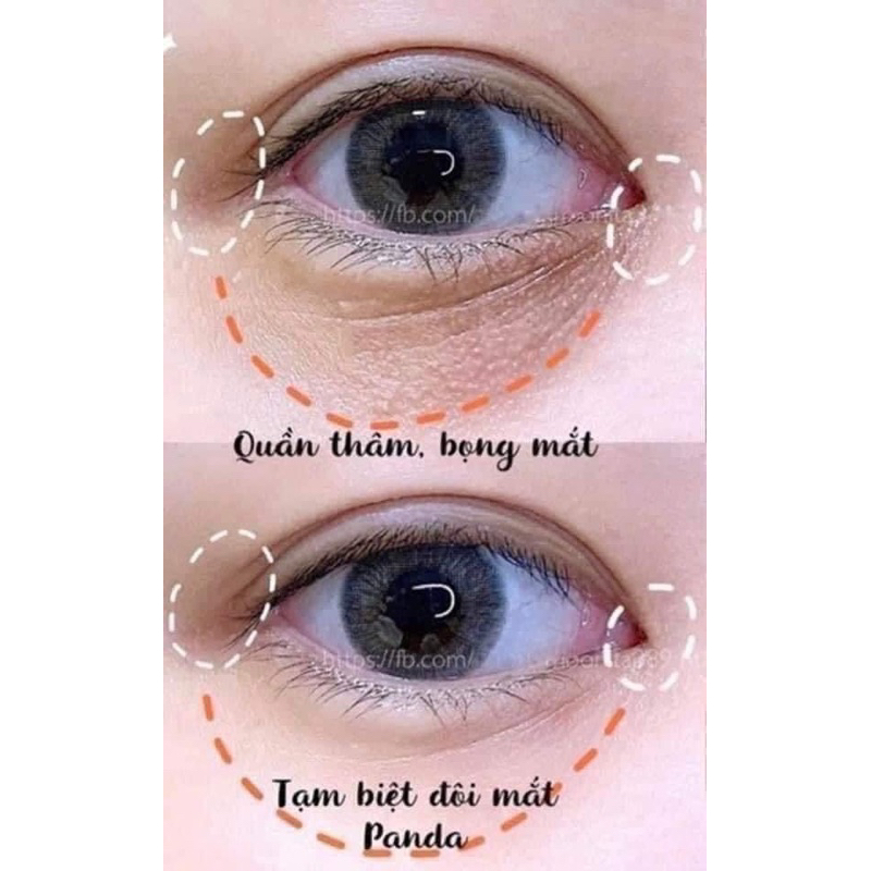 Tinh chất dưỡng trắng da vùng mắt Memoto Omoi Eyes All In One Essence Nhật Bản