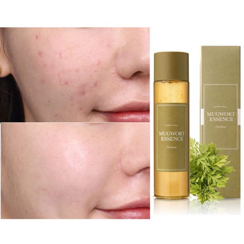 Tinh Chất Dưỡng Làm Dịu và Phục Hồi I’m From Mugwort Essence Mini 30ml