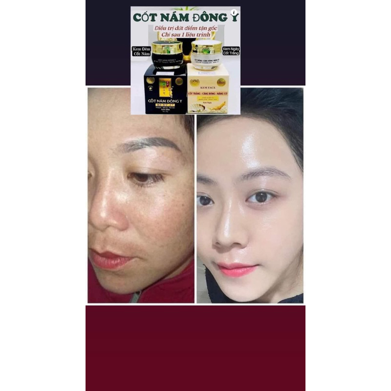 Combo Kem Face Cốt Nám Đông Y Nikos Chính Hãng- Kem Face Nikos Cốt Trắng Căng Bóng Nâng Cơ