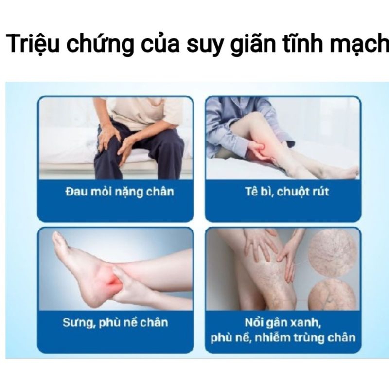 Kem Bôi Suy Giãn Tĩnh Mạch Ngăn Tái Lại - Giảm Đau Nhức, Tăng Cường Lưu Thông, Ngừa Chuột Rút (20g)