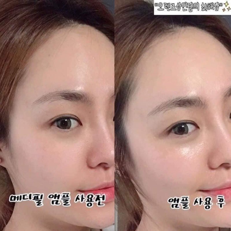 TONER DƯỠNG TRẮNG NIACINAMIDE 11% WATER ESSENCE