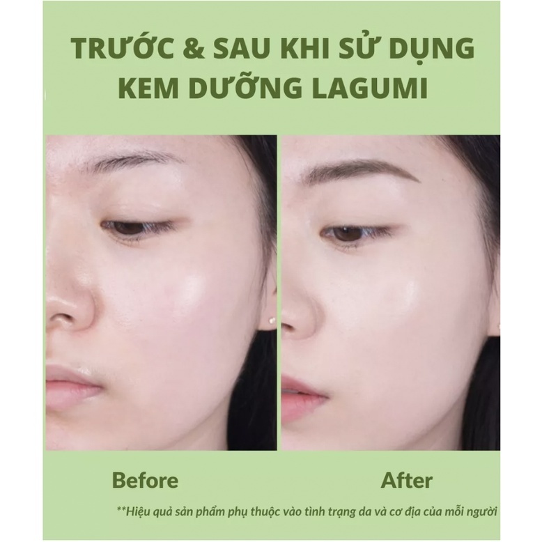 Kem dưỡng ẩm LAGUMI cho da dầu, mụn với B5, Calendula cấp ẩm, kiềm dầu, giảm thâm mụn 30g an toàn cho mẹ bầu - BIBABO | BigBuy360 - bigbuy360.vn