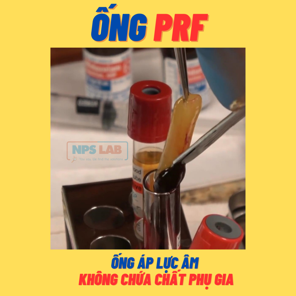 Ống lấy máu chuyên dùng để tách PRF