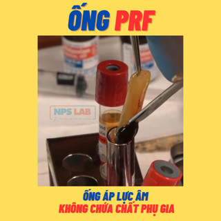 Ống lấy máu dùng để tách PRF