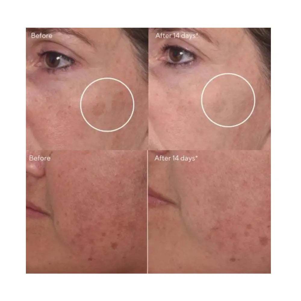 Bộ Sản Phẩm Phục Hồi, Giảm Thâm Nám Murad Glow On Demand Luminosite Sur Demande