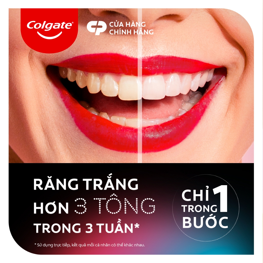 Bút trắng răng Colgate Optic White O2 2,5ML răng trắng 3 tông an toàn, không ê buốt