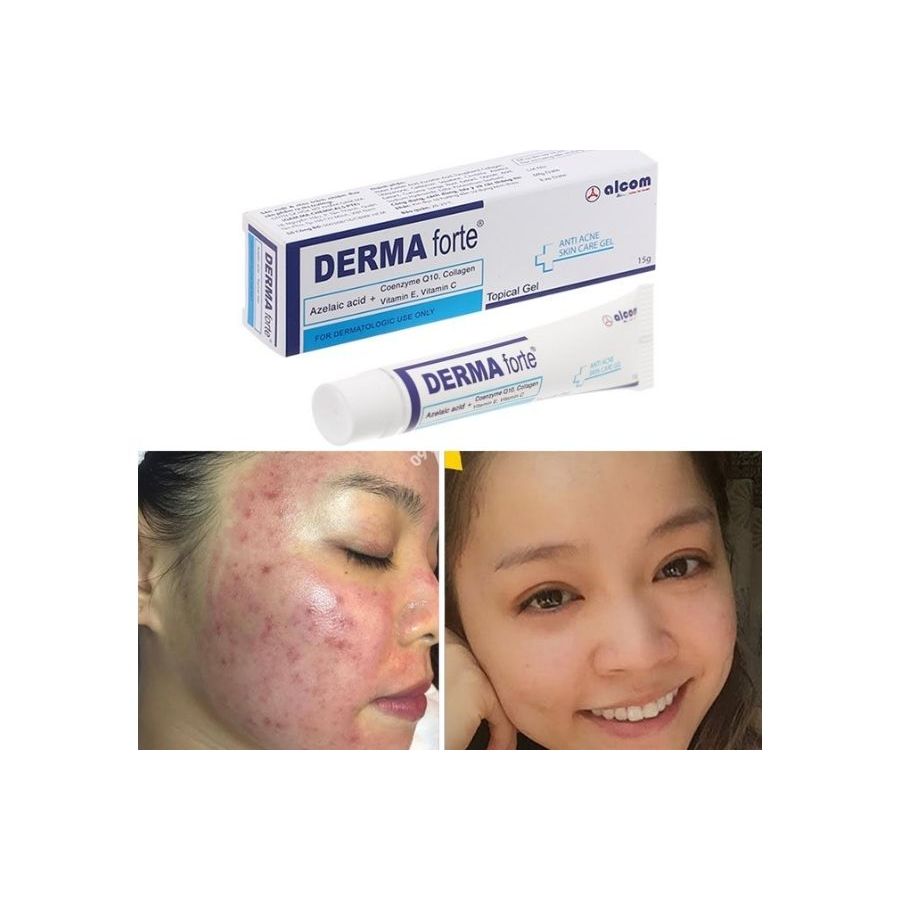 Gel giảm mụn và Thâm Derma Forte 15g