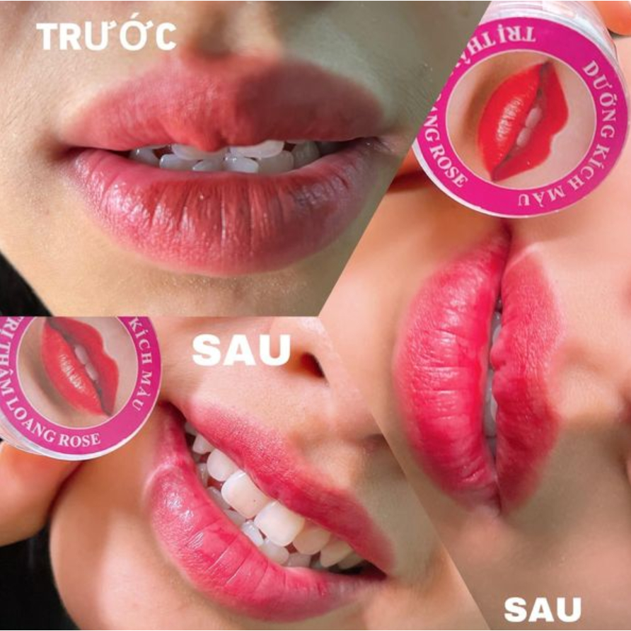 DƯỠNG KÍCH MÀU THÂM LOANG ROSE DÙNG SAU PHUN XĂM