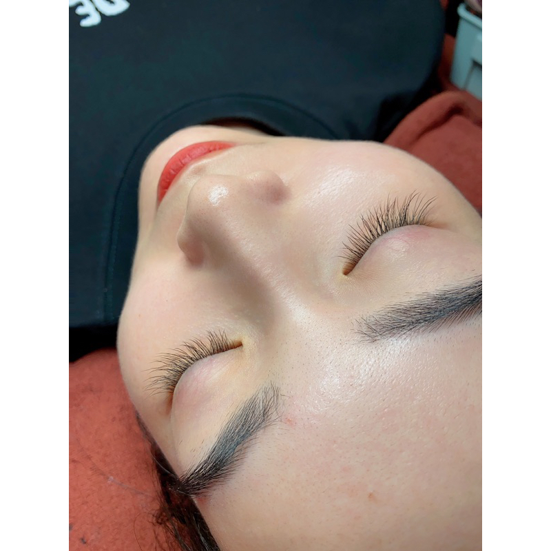 Mi em bé cong nhẹ