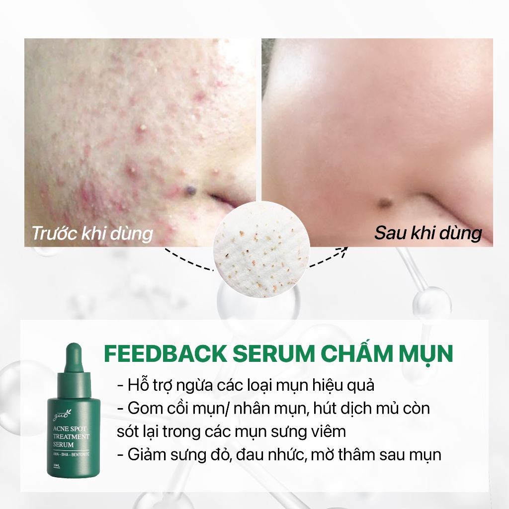 Serum giảm mụn, mờ thâm BHA 1%+AHA 2%+tràm trà, giảm sợi bã nhờn hiệu quả GUO 30ml