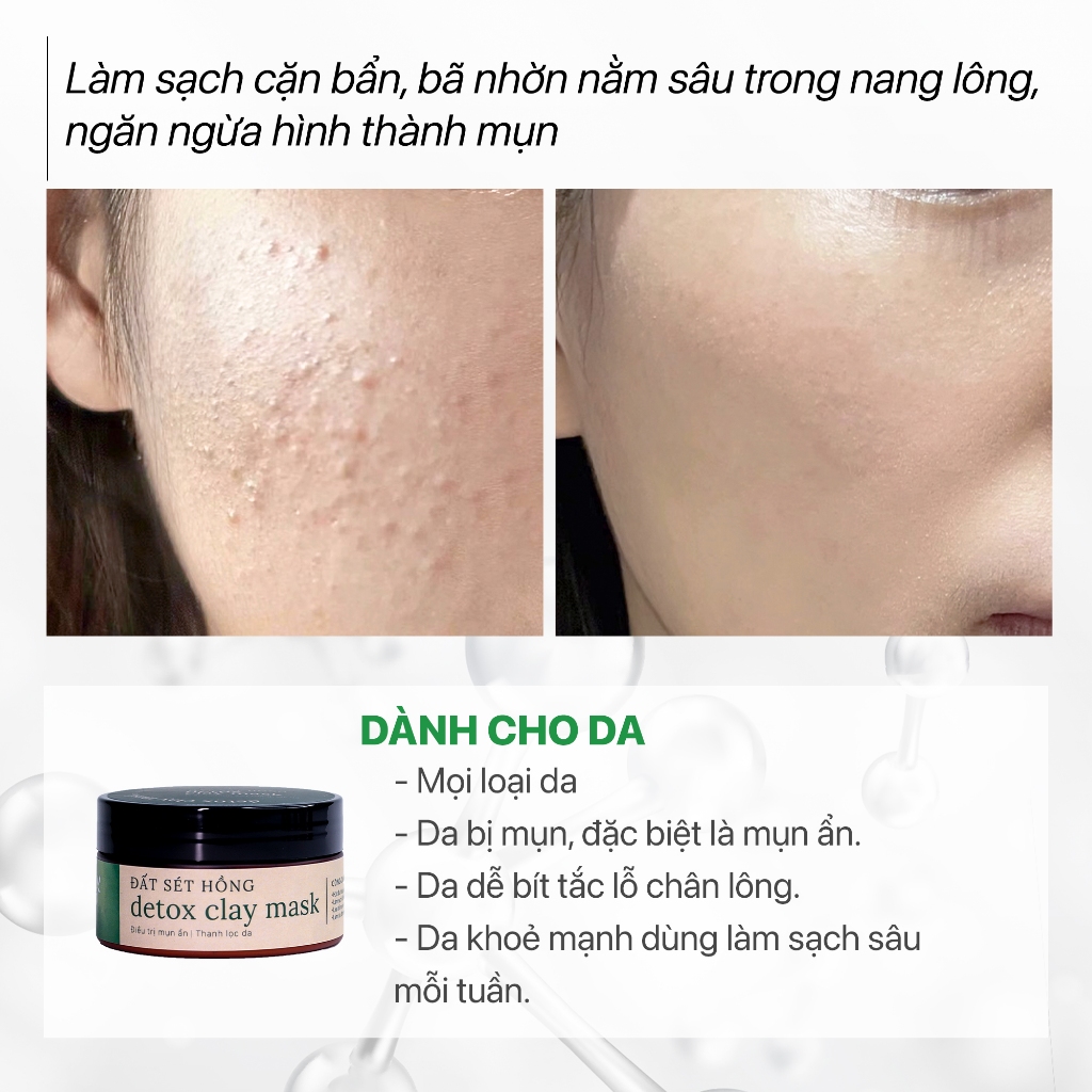 [Giảm mụn ẩn hiệu quả] Mặt Nạ Thải Độc Đất Sét Hồng Pháp Ngừa Mụn GUO -Detox Clay Mask 100gr