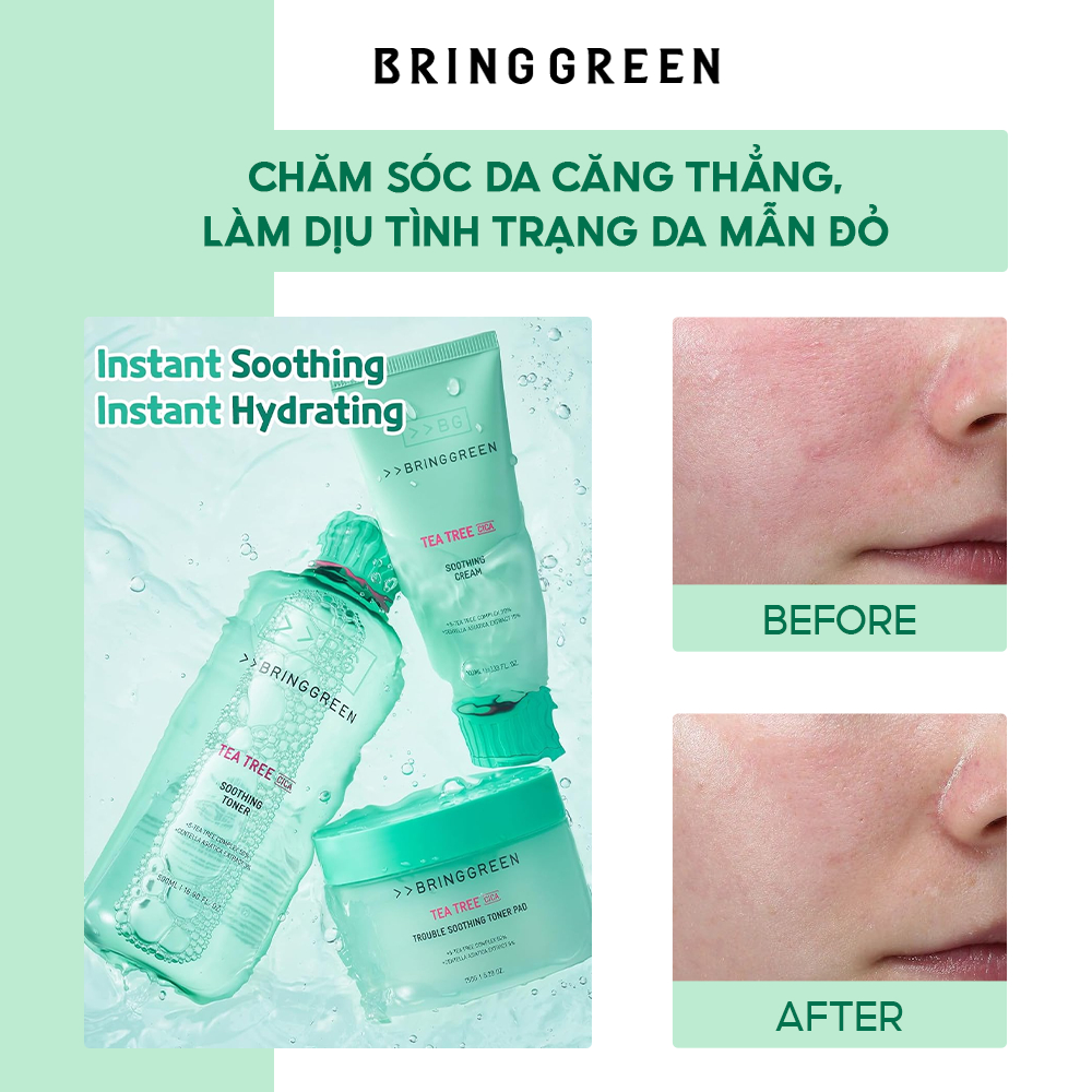 Nước Hoa Hồng Giảm Mụn Làm Dịu Da Tràm Trà BRING GREEN Tea Tree Cica Soothing Toner 250ml/ 510ml