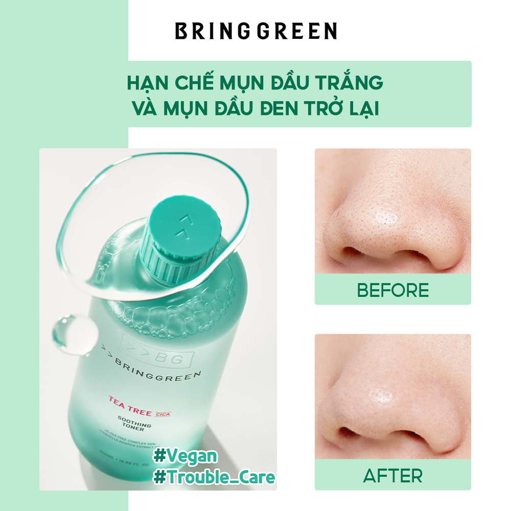 Nước Hoa Hồng Giảm Mụn Làm Dịu Da Tràm Trà BRING GREEN Tea Tree Cica Soothing Toner 250ml/ 510ml