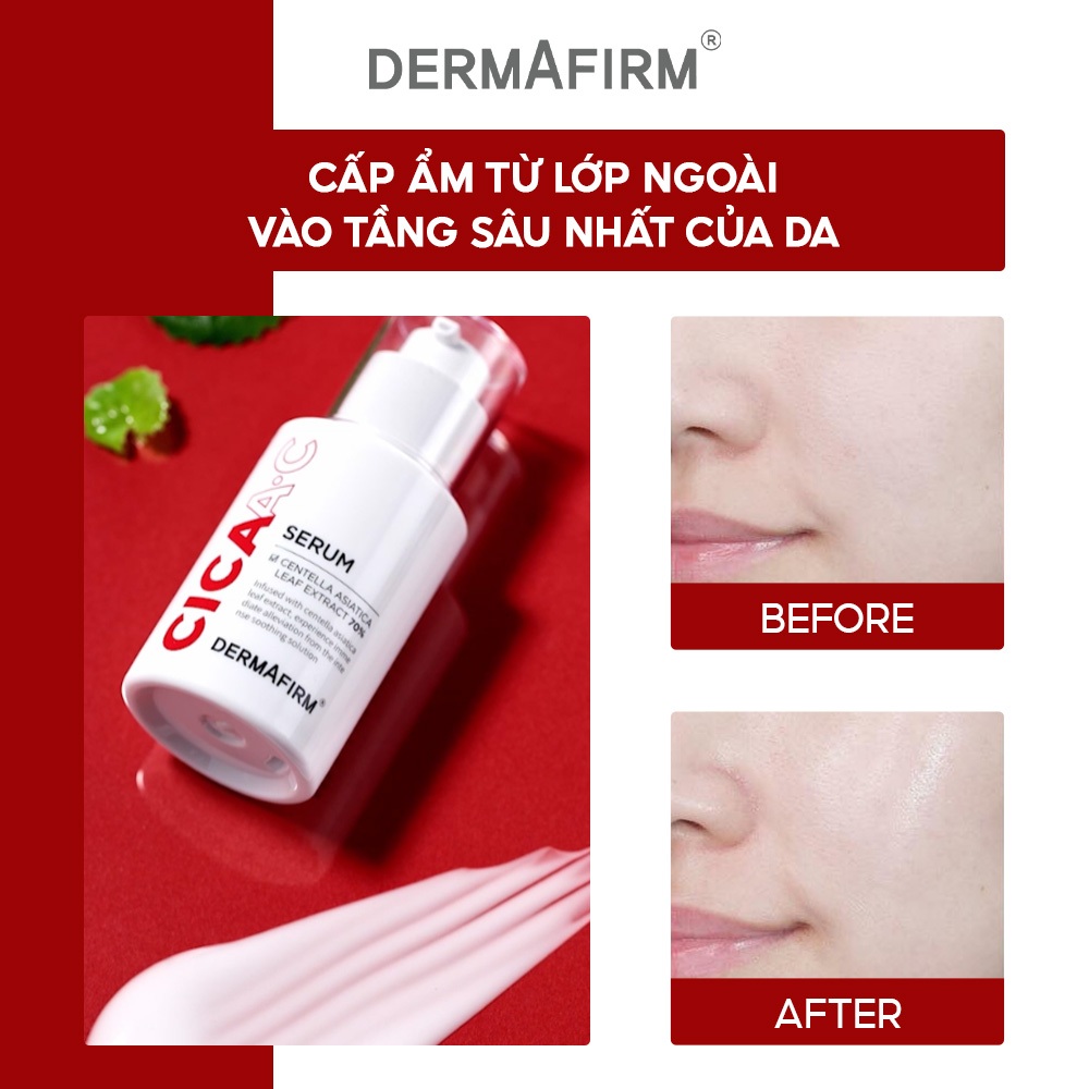 Tinh Chất Cấp Ẩm Chuyên Sâu, Làm Sáng Da, Làm Dịu Da DERMAFIRM CICAA.C SERUM 30ml