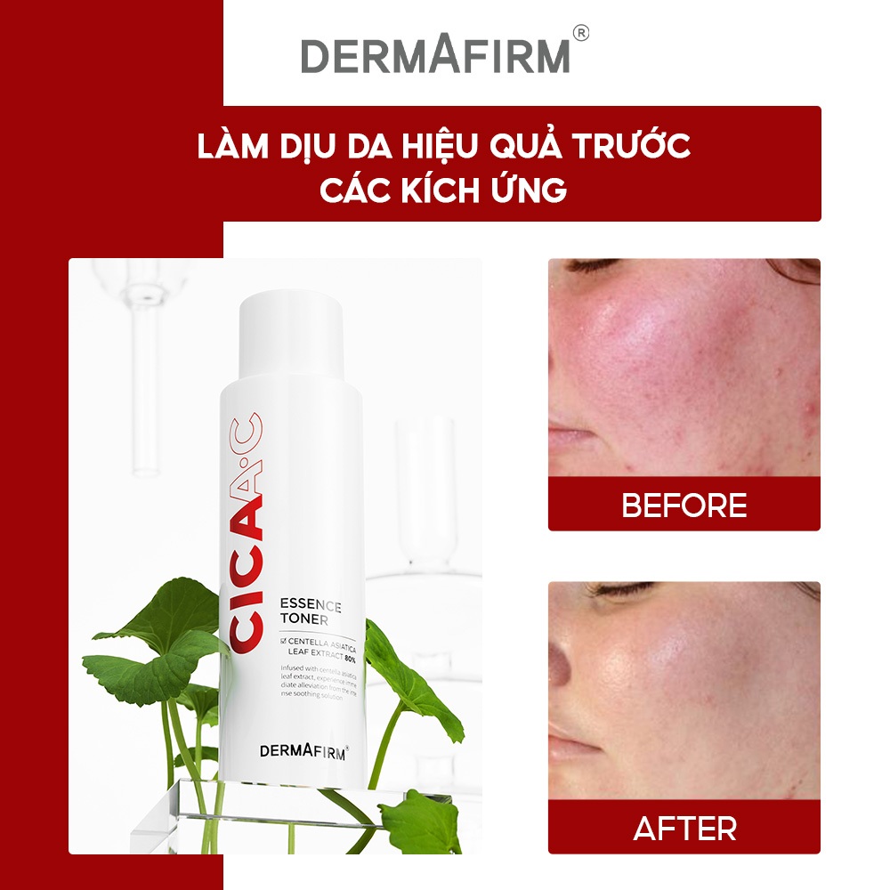 Nước Hoa Hồng Cấp Ẩm,  Làm Dịu Da DERMAFIRM CICAA.C ESSENCE TONER 150ml