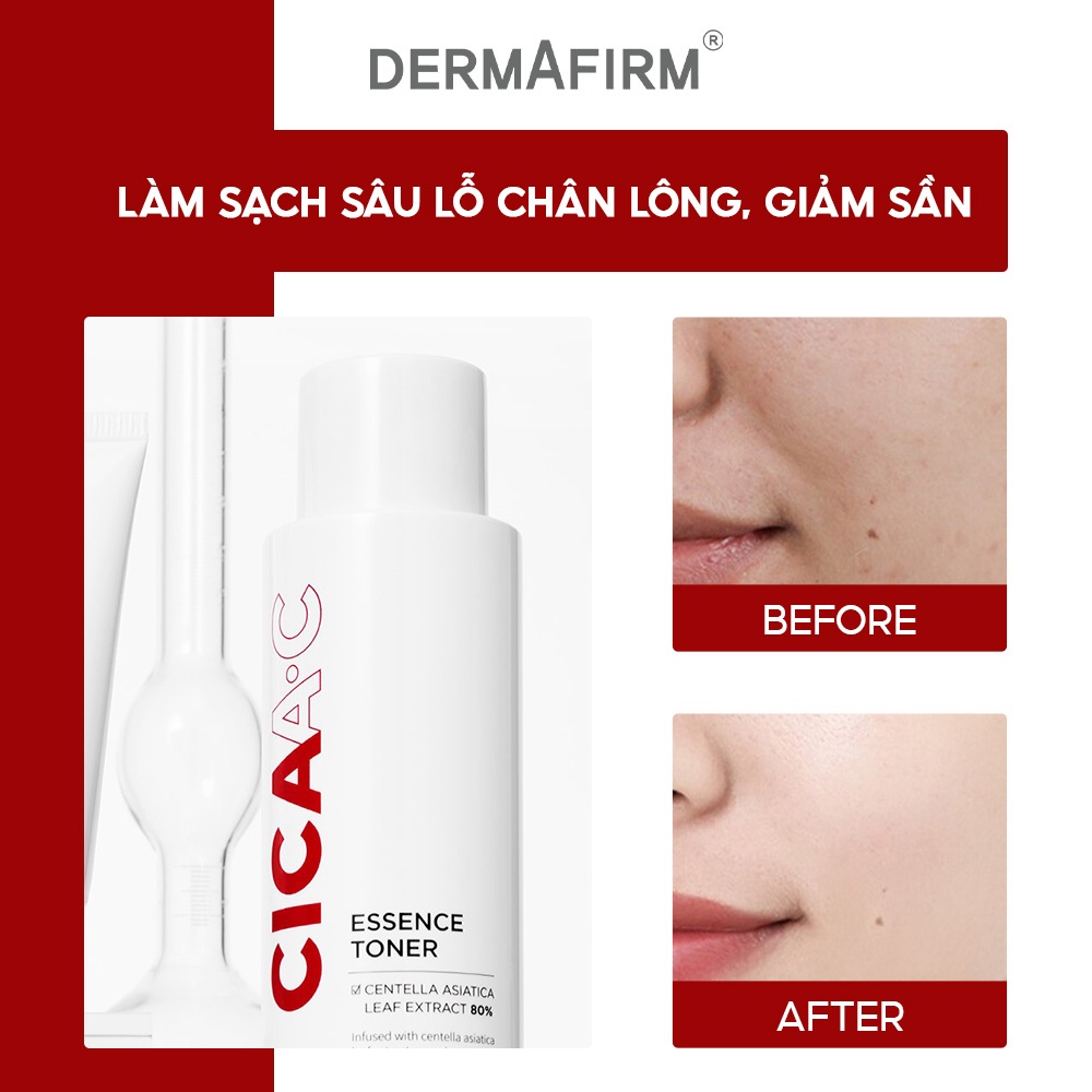Nước Hoa Hồng Cấp Ẩm,  Làm Dịu Da DERMAFIRM CICAA.C ESSENCE TONER 150ml